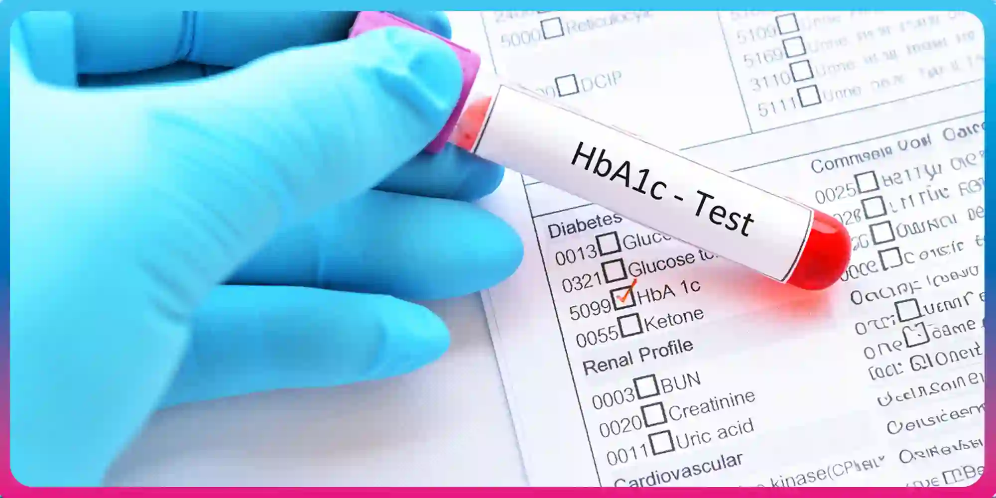 HbA1c Test Guide
