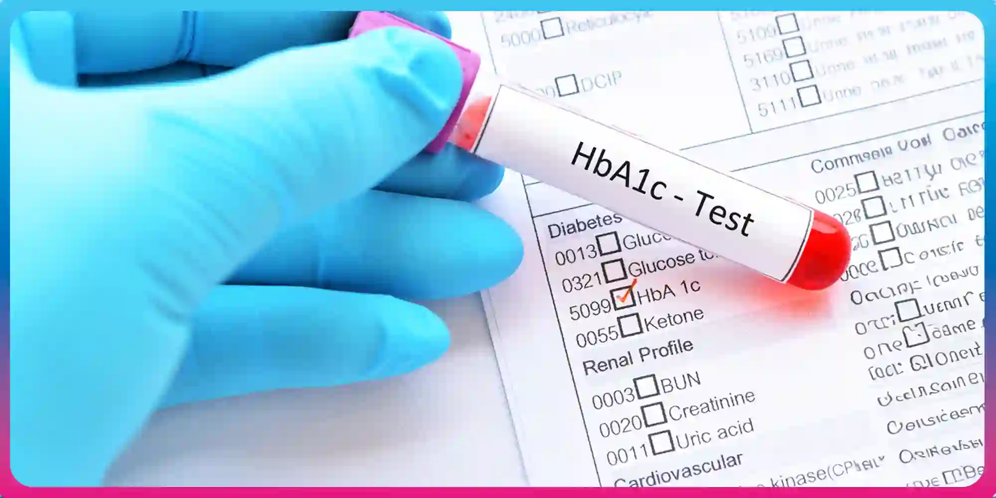 HbA1c Test Guide: Normal Range, Levels, and Significance HbA1c Test Guide