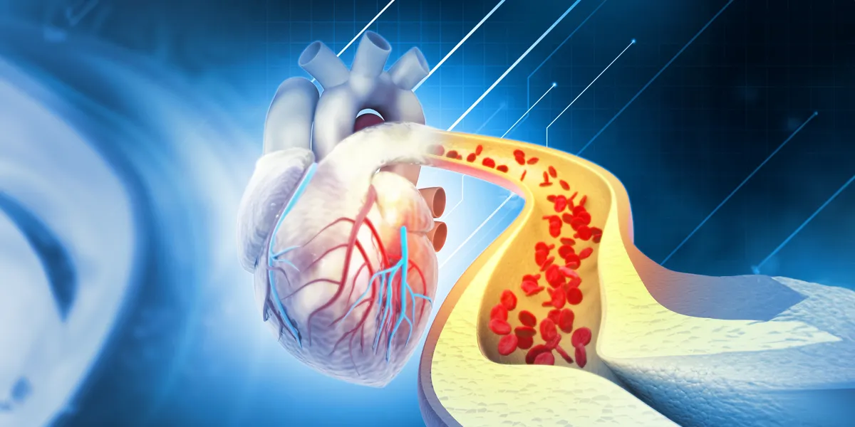 How Do you Reduce Cholesterol Naturally? reduce cholesterol naturally
