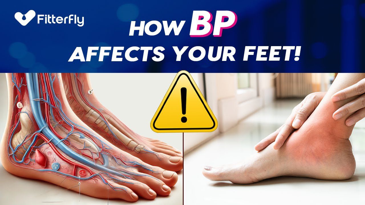 Why Does High Blood Pressure Cause Swelling in Legs and Feet?